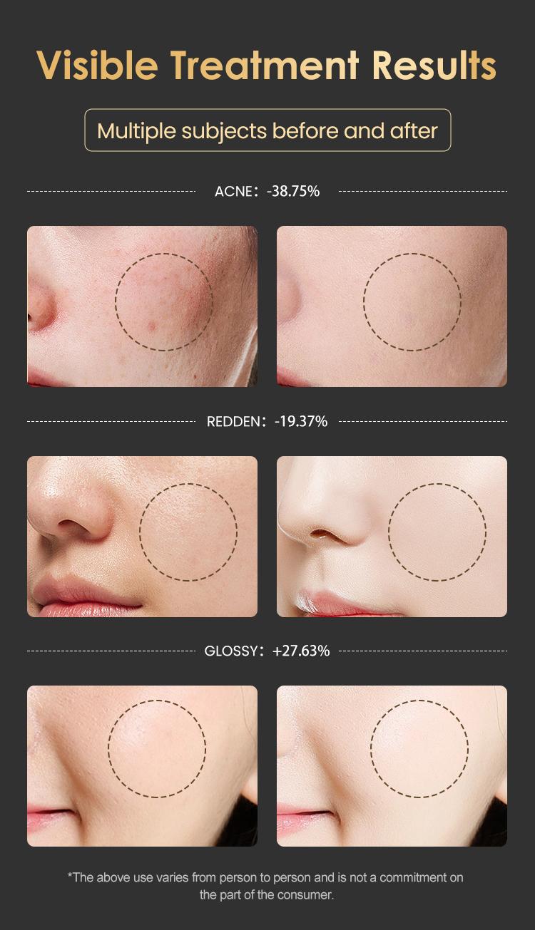 Red Light Therapy Mask with Vibration