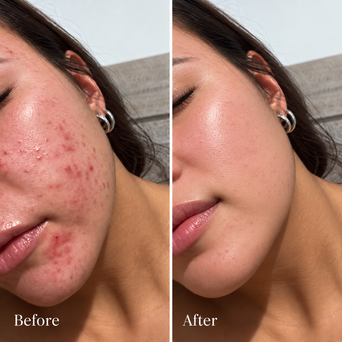Before and after skincare results