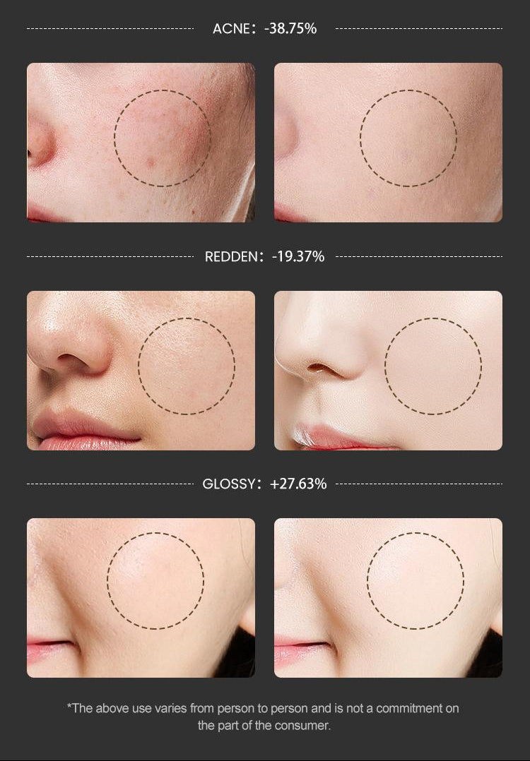 Before and after of a person's face who used the red light therapy mask